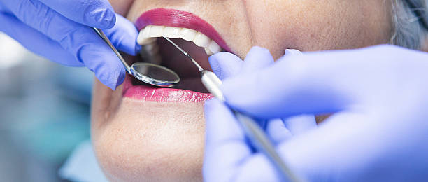 Best Urgent Care for Lost Fillings or Crowns in Elmsford, NY